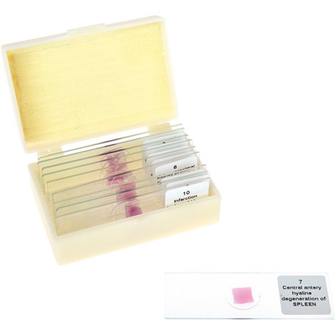 Set 10 lamele cu preparate microscopice, Tesuturi umane afectate, 7,6 x 2,5 x 0,1 cm, uz didactic